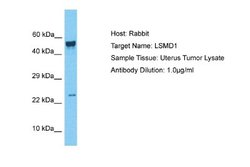 LSMD1 Rabbit anti-Human, Polyclonal, Novus Biologicals 0.1 mL | Buy Online | Novus Biologicals | Fisher Scientific